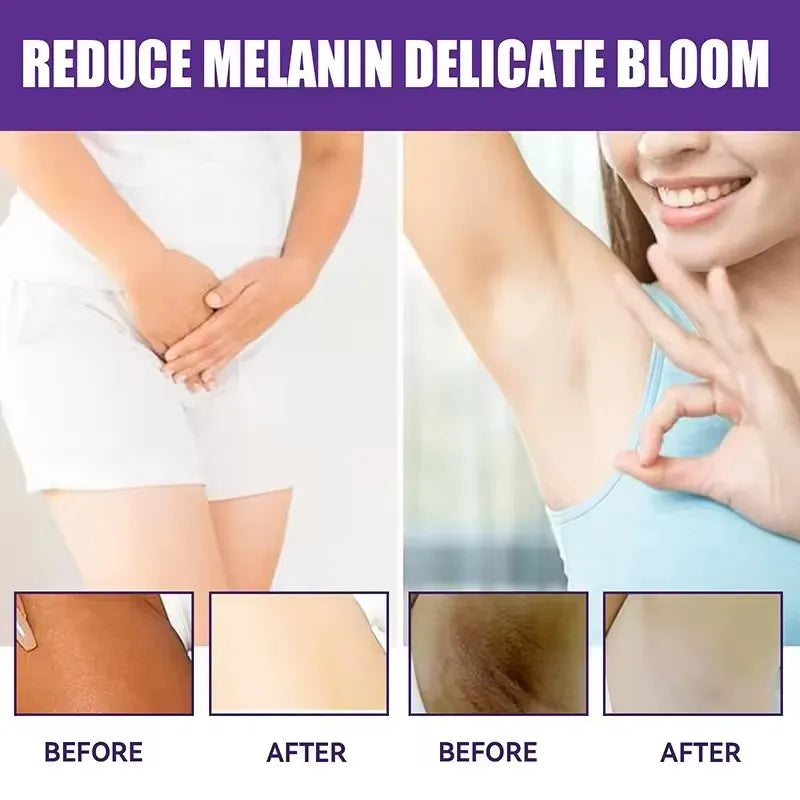 50g Body Underarm Whitening Cream Private Parts Bleaching Whiten Butt Knee Brighten Inner Thigh Intimate Dark Remove Melanin