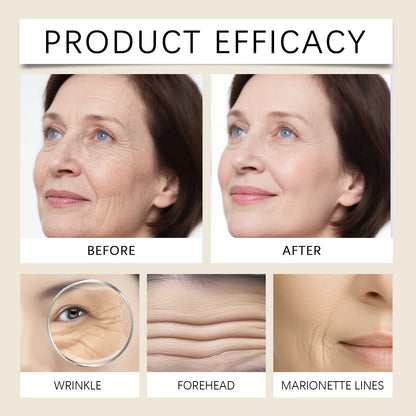 Retinol Moisturizer Cream Anti Wrinkle Hydrating Winter Skincare  Deep Hydration Lock Gentle Nourishing Lasting Moisturization