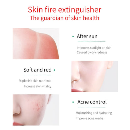 FONCE Organic Pure Aloe Vera Gel 300g Moisturizing Cream Sunburn Aloe Gel Natural Safe Sleeping Mask Soothing Lotion