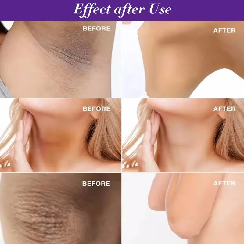 50g Body Underarm Whitening Cream Private Parts Bleaching Whiten Butt Knee Brighten Inner Thigh Intimate Dark Remove Melanin